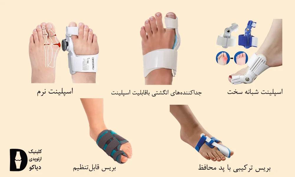 بریس‌ها و اسپلینت‌ها
