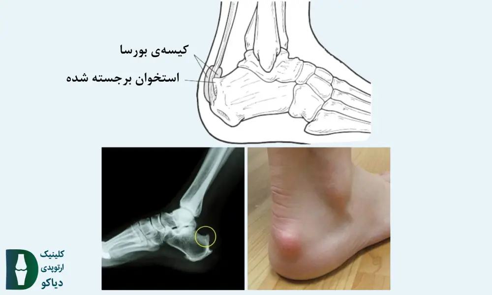 هاگلند