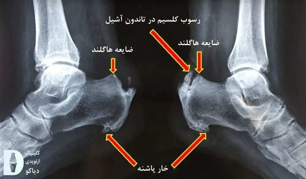 هاگلند