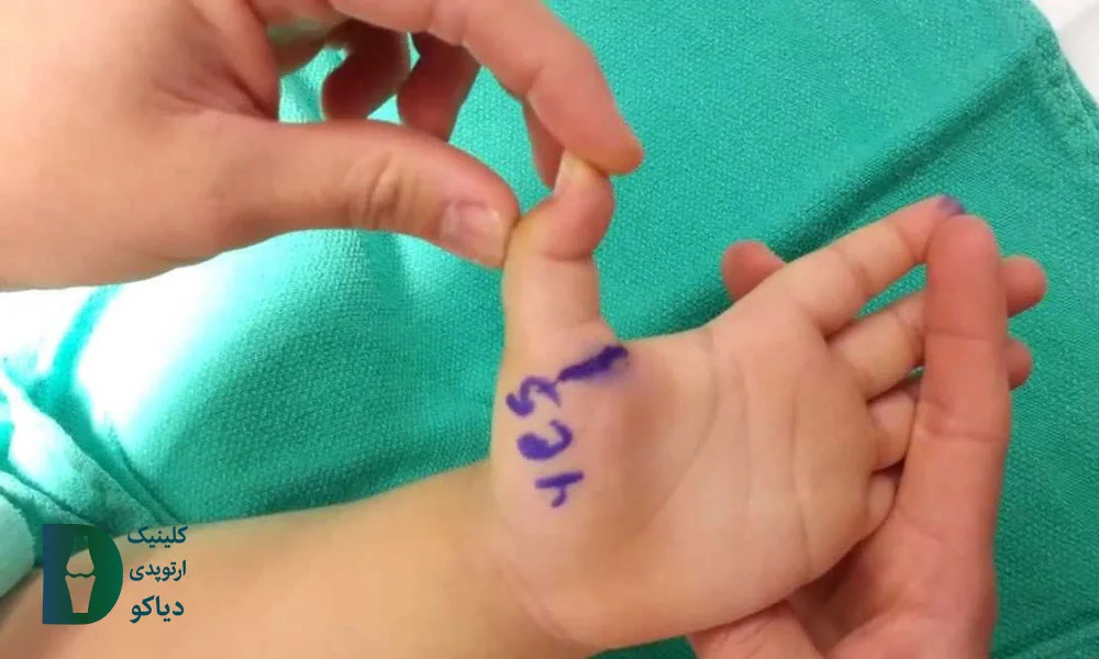 جراحی برای کودک