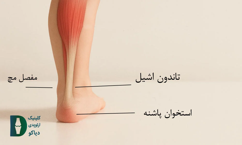 نشانه‌های کوتاهی تاندون آشیل