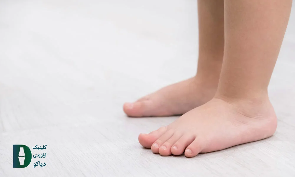 نقایص اسکلتی – ساختاری
