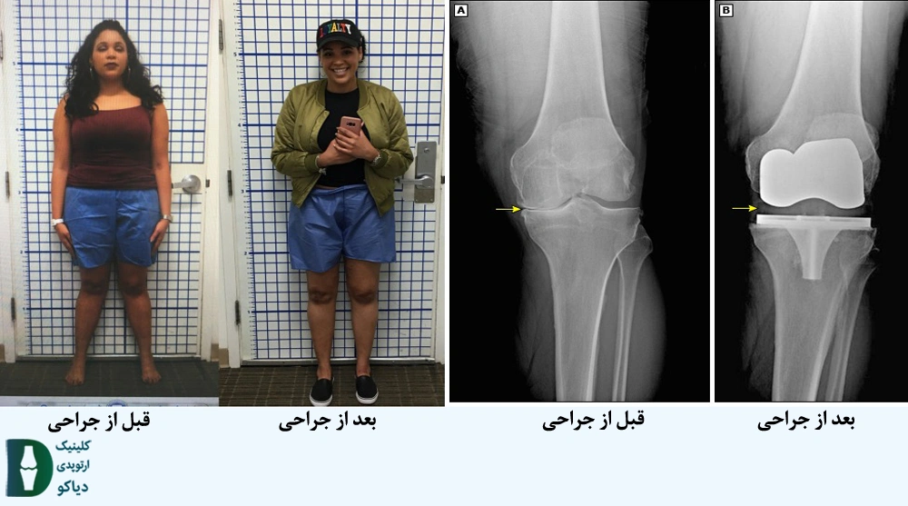 بعد از جراحی