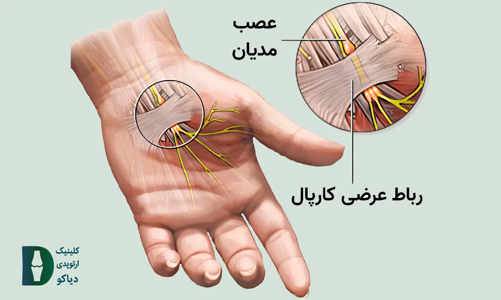 عصب مدیان