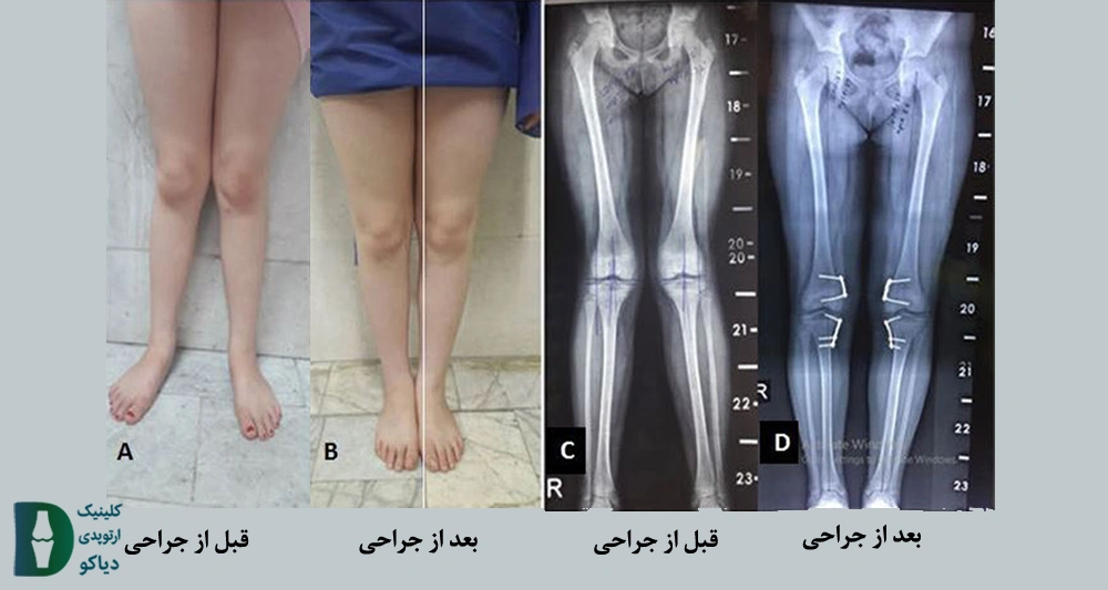 جراحی هدایت رشد