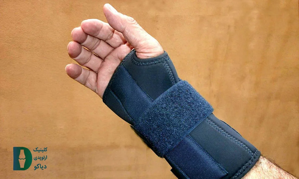 مچ‌بند شبانه