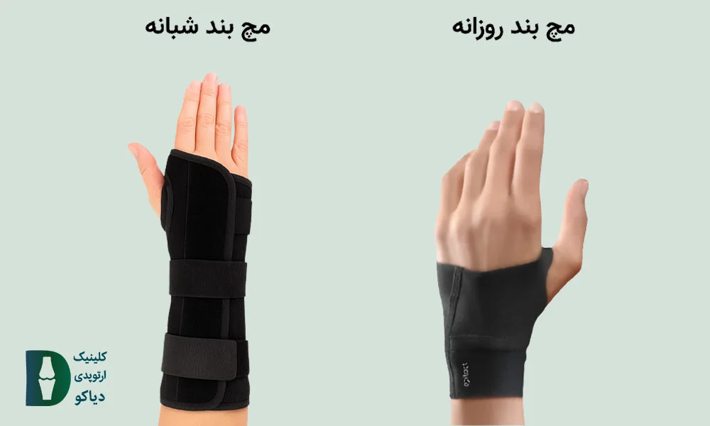 مچ‌بند مناسب