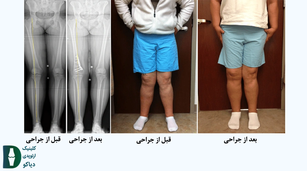 جراحی