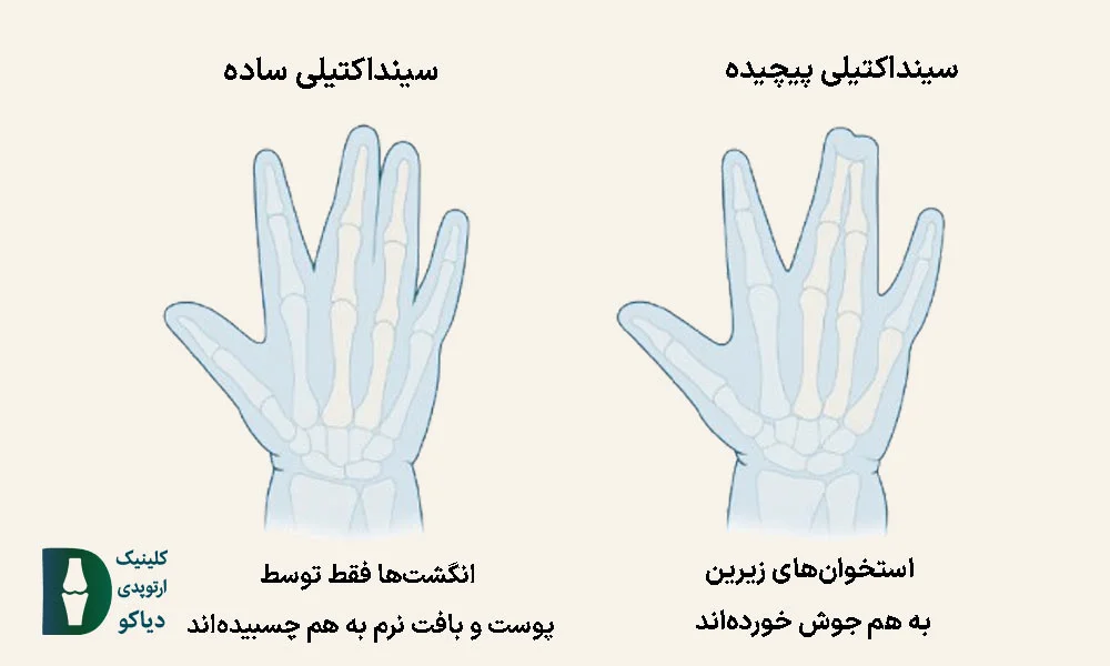 نوع چسبندگی