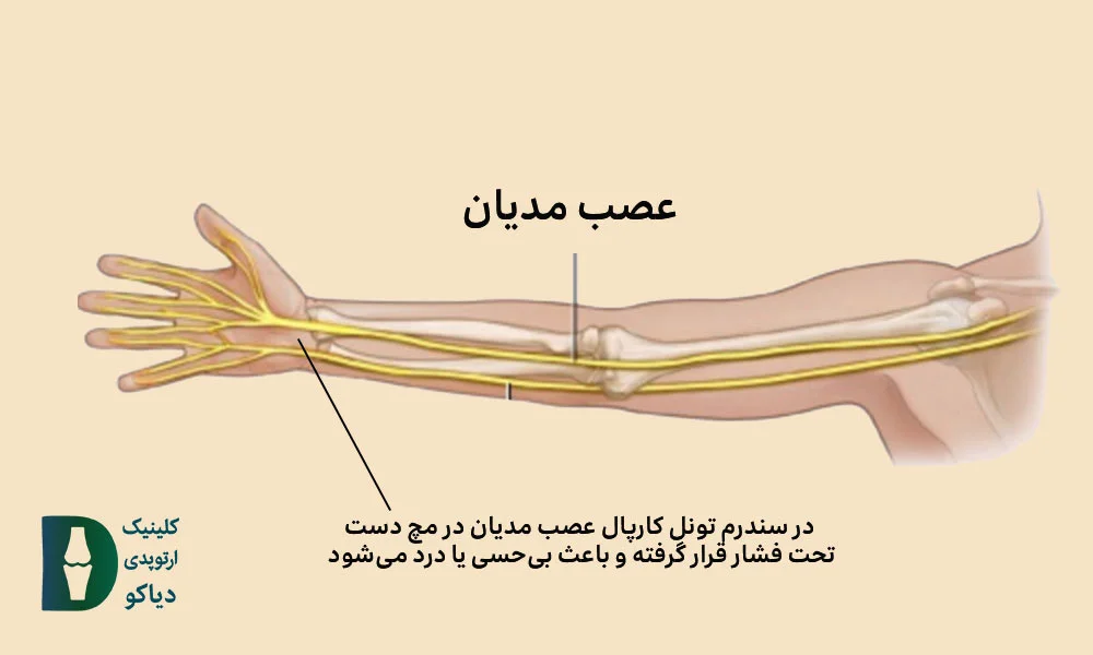 عصب مدیان