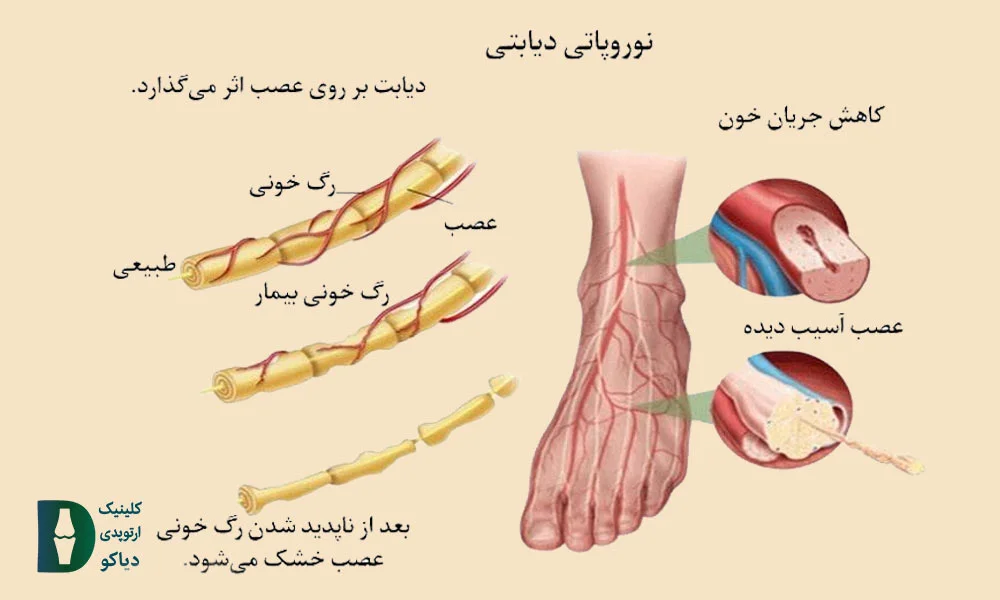 مورمور