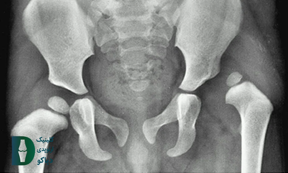 عکس‌برداری با اشعه ایکس (X-ray)