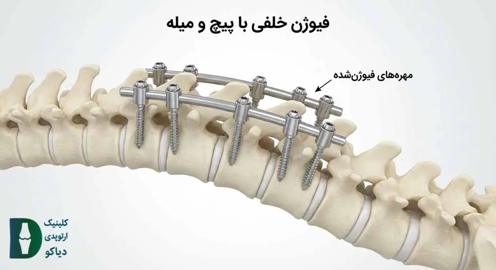 فیوژن
