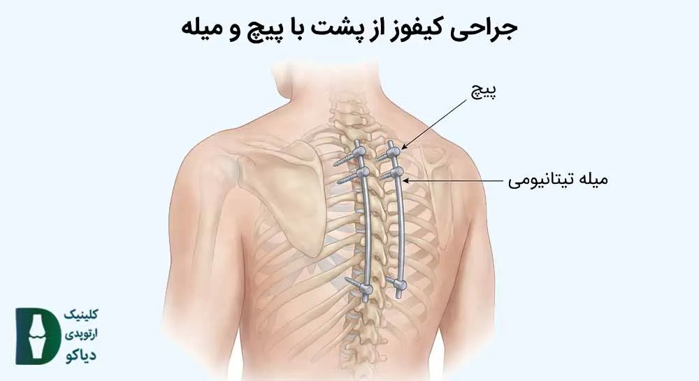ستون فقرات