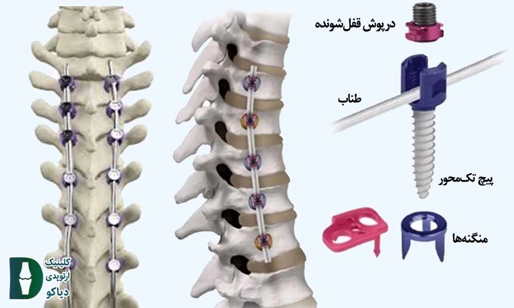 ستون فقرات