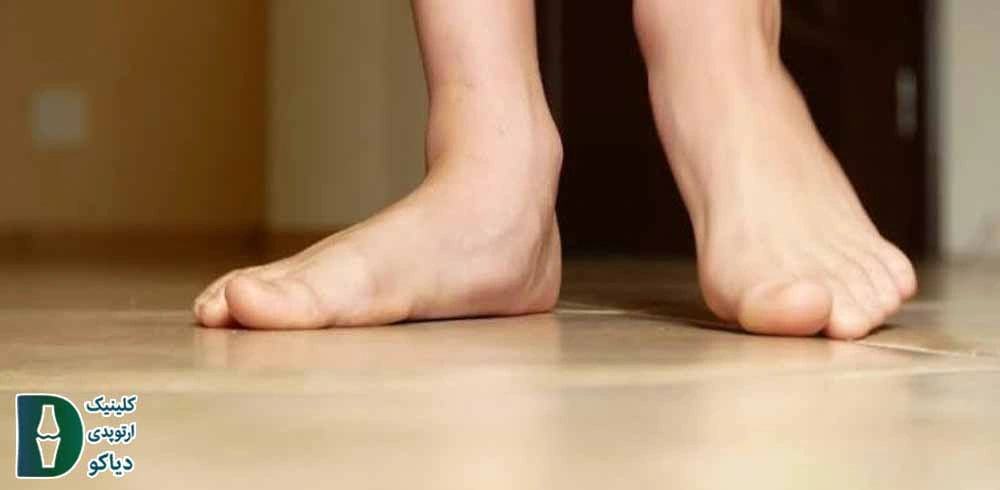 صافی کف پای سخت