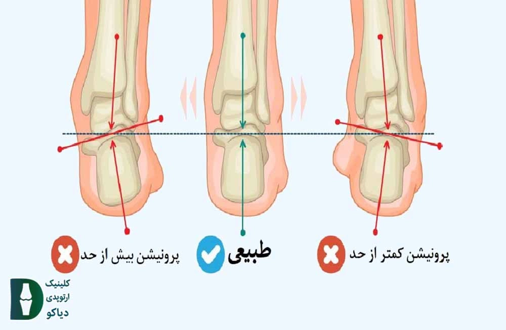 حرکت مچ