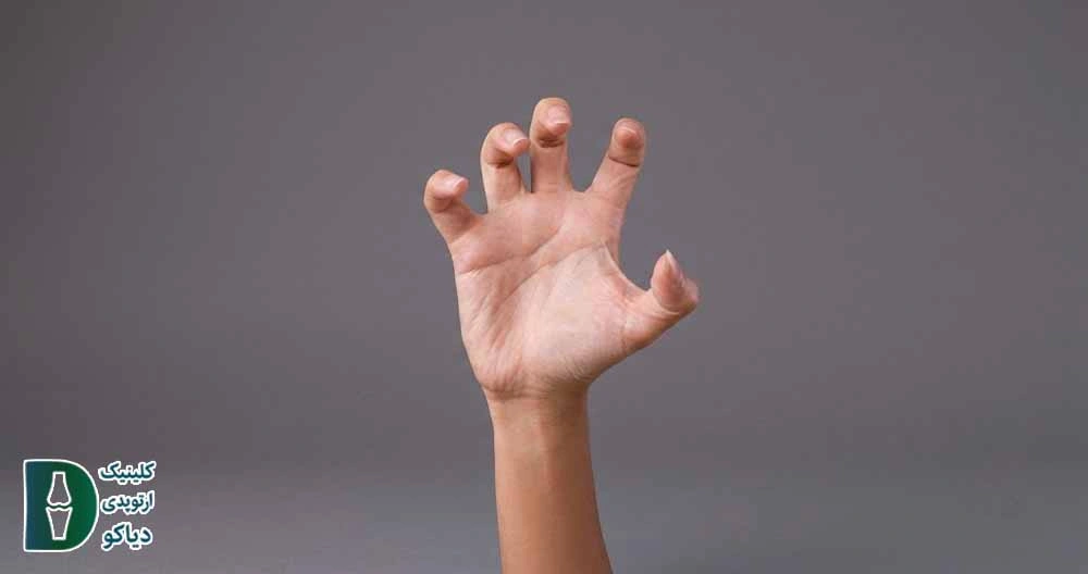 تمرین پنجه گربه