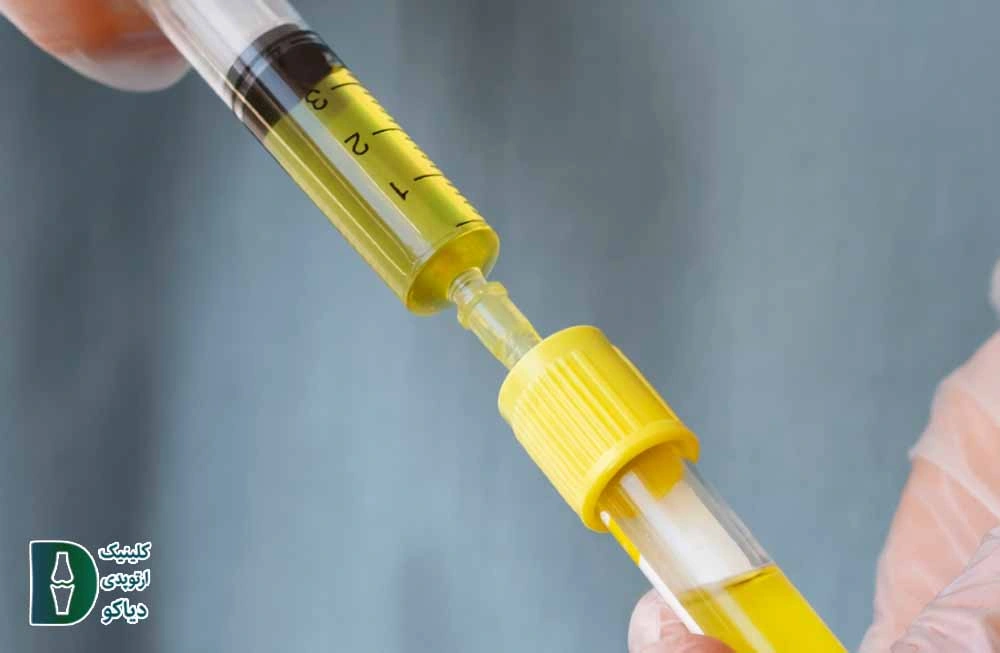 تزریق PRP
