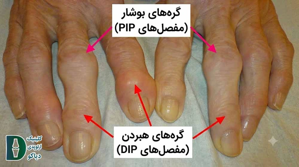 برجستگی