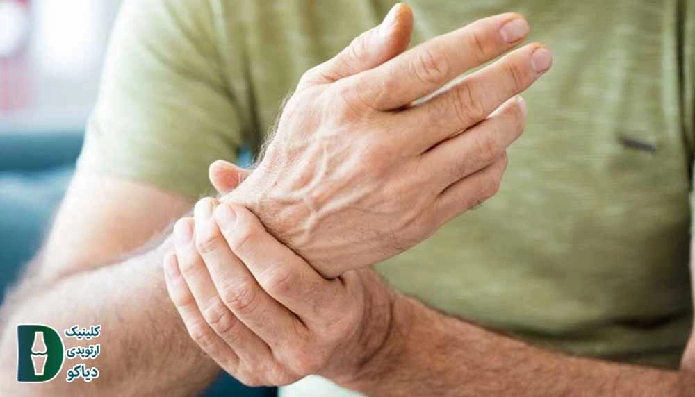 آرتروز مچ دست