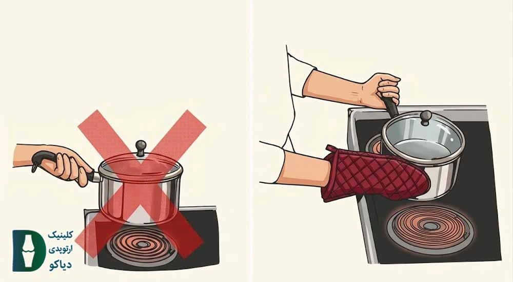 آرتروز مچ دست