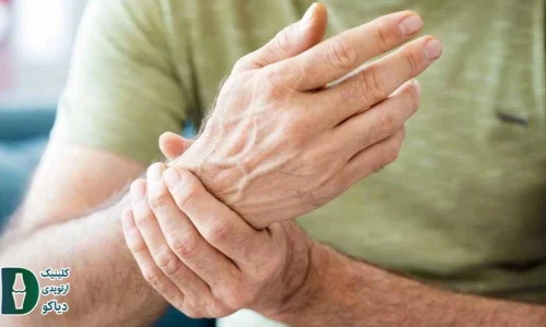 آرتروز مچ دست