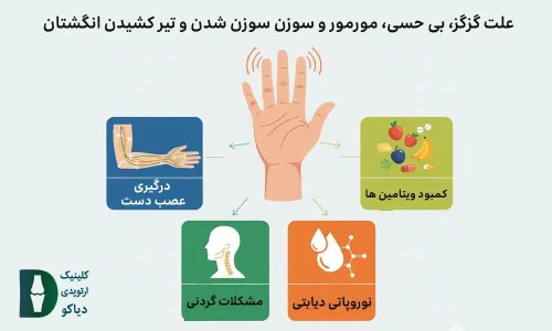 گزگز انگشتان دست